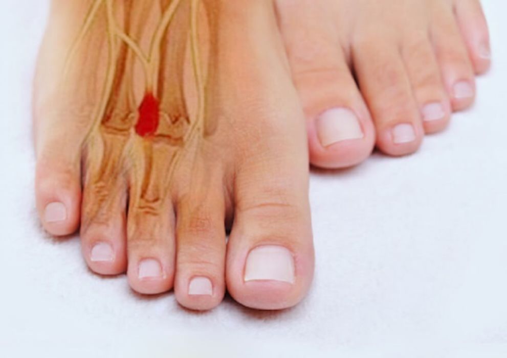 Малоинвазивная хирургия стопы: преимущества и сроки восстановления в 2025 году