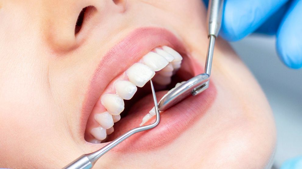 Лечение зубов по ОМС: актуальный порядок оказания услуг